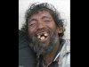 dientes.jpg